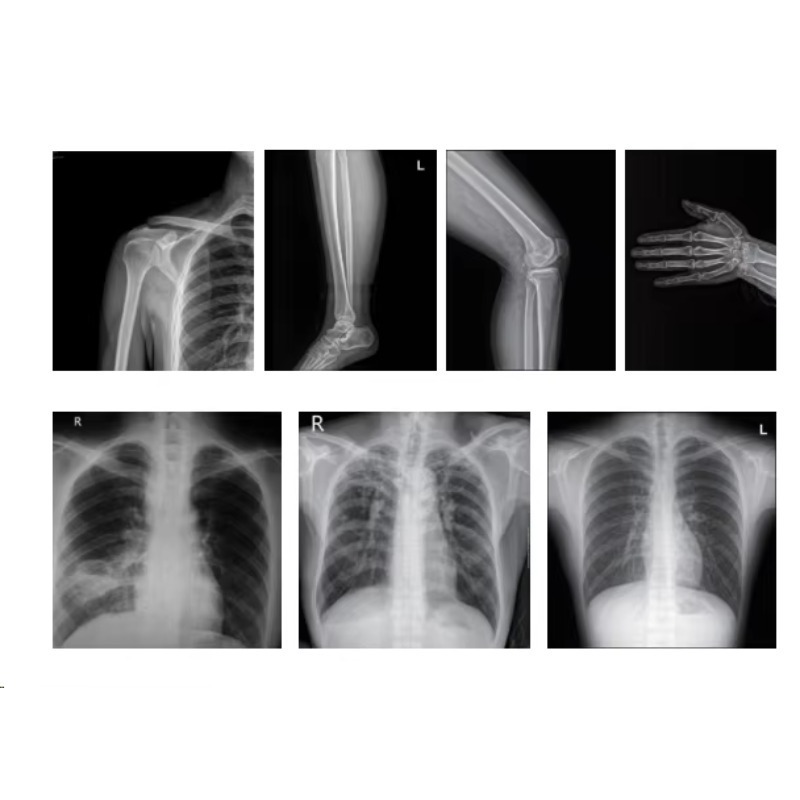 Máquina de Imagem Médica por R - Photography X Ray avaliação e preço